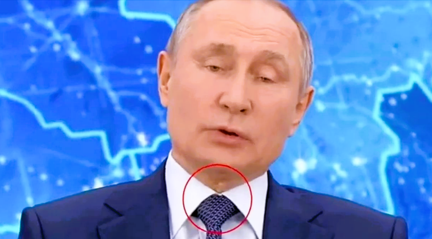 Putin tot?! Narbe am Hals soll es beweisen - Putin wurde schon einmal wiederbelebt!